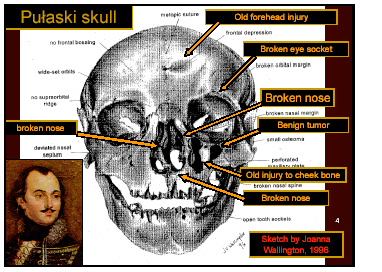 [Pulaski Skull ]